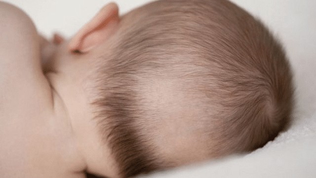 Trẻ sơ sinh rụng tóc vành khăn